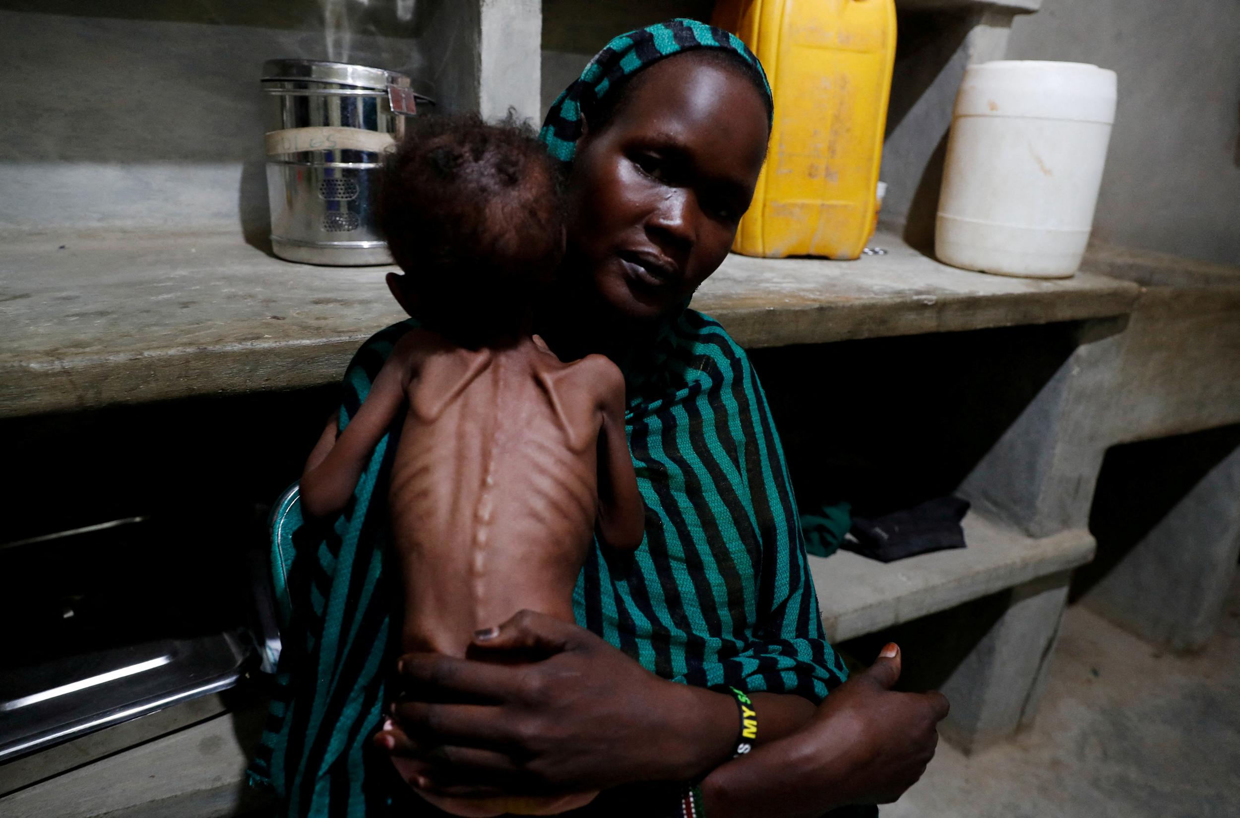 A mother holds her severely malnourished child at the paediatric ward of the Mother of Mercy Hospital in Gidel, South Kordofan, Sudan, 25 June 2024. Thomas Mukoya via Reuters
